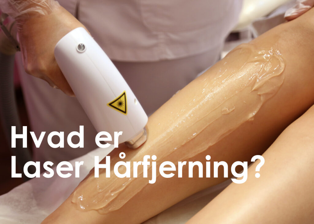 laser haarfjerning på ben med teksten "hvad er laser haarfjerning?"